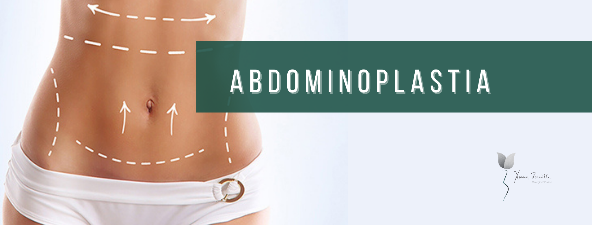 Abdominoplastia: Estética, autoestima e saúde